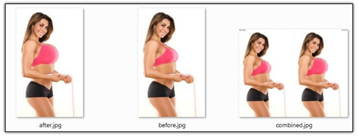 整容模擬器電腦版 整容模擬器電腦版